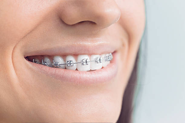 Best Veneers and Lumineers  in Lewisburg, OH